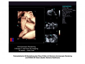 SH Amnioscopic 1 prev